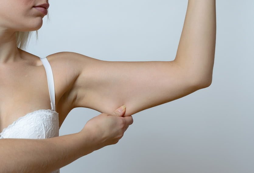 Arm Lift https://caurishealthru.com/wp-content/uploads/2024/01/Arm-Lift.jpg