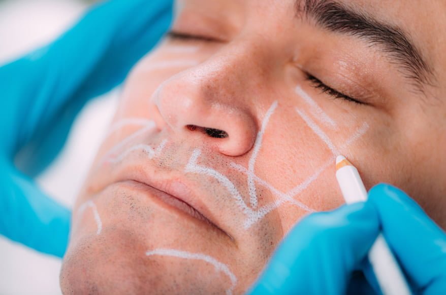 Facial Fat Grafting https://caurishealthru.com/wp-content/uploads/2024/01/Facial-Fat-Grafting.jpg