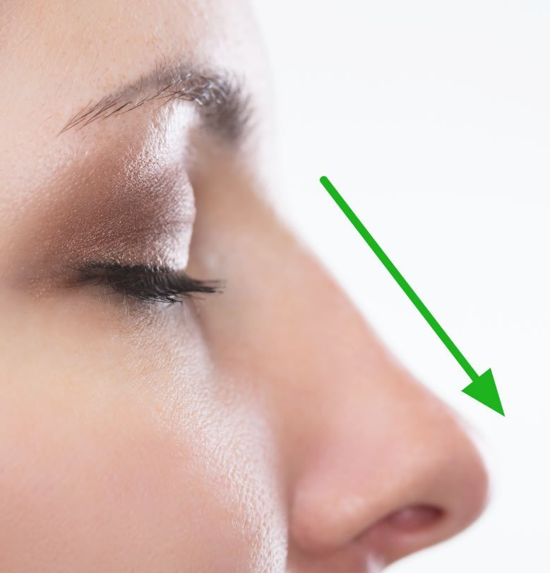 Nose Job https://caurishealthru.com/wp-content/uploads/2024/01/Nose-Job.jpg