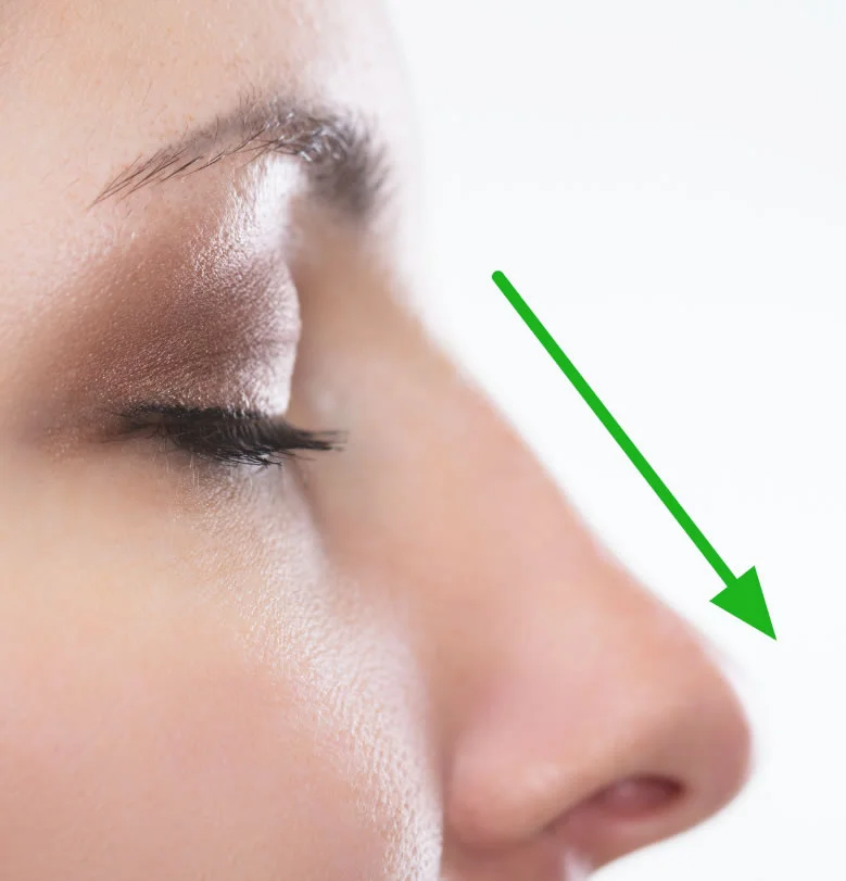 https://caurishealthru.com/wp-content/uploads/2024/01/Nose-Job.jpg