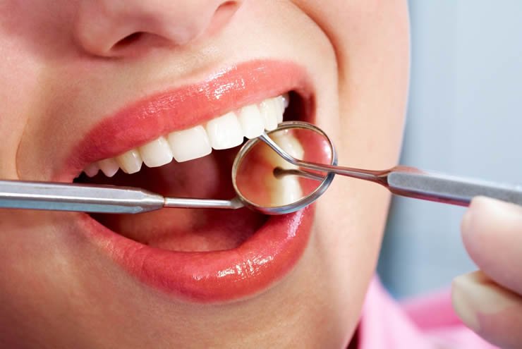 dental https://caurishealthru.com/wp-content/uploads/2024/01/dental.jpg