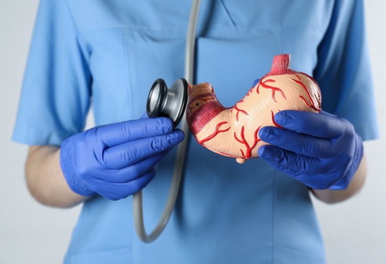 gastric-1 https://caurishealthru.com/wp-content/uploads/2024/01/gastric-1.jpg